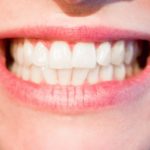Piękne zdrowe zęby również doskonały cudny uśmiech to powód do płenego uśmiechu.